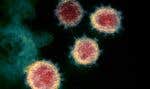 Observation datant de 2020 au microscope électronique du virus SRAS-CoV2, par les National Institutes of Health des États-Unis. L’OMS a décidé de classer le nouveau sous-variant BA.2.86 «sous surveillance en raison du très grand nombre (supérieur à 30) de mutations du gène Spike qu’il porte».